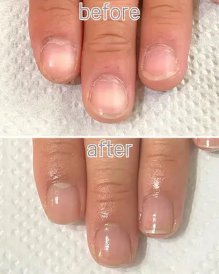 ネイル 自爪育成専門店 Kapilinaのネイルデザイン