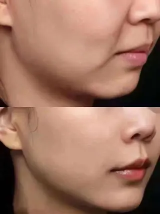 ショート カラー キッズ ネイル マツエク・マツパ aliaハーブ水光店 エステティシャン募集のエステ・リラクイメージ