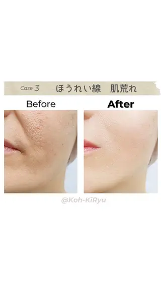 体質改善✨美肌育サロ ン 香嬉琉🌿きよかのエステ・リラクイメージ