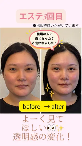 フェイシャルサロン ビアンカガーデンのエステ・リラクイメージ