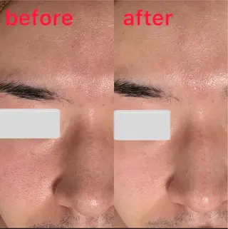 肌質改善サロン La Divinaのエステ・リラクイメージ