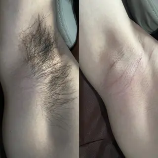 Mr.＆Ms.脱毛/ 眉毛ワックスのエステ・リラクイメージ