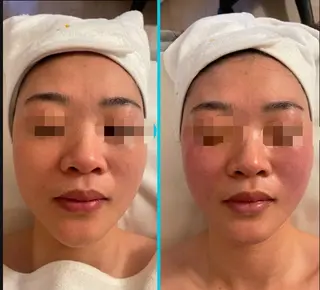 M 🌱naturalのエステ・リラクイメージ