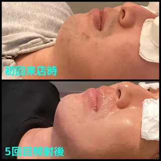 メンズ men's脱毛サロン ECXIAのエステ・リラクイメージ