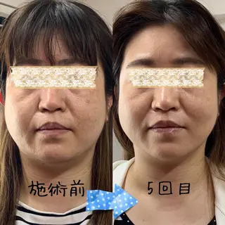 リラクゼーション サロンせいらんのエステ・リラクイメージ