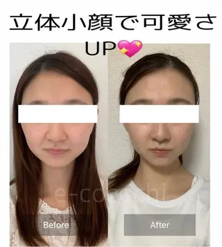 小顔と ヘッドスパのお店のエステ・リラクイメージ