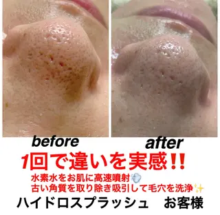 ネイル・エステサロン UILANIのネイルデザイン