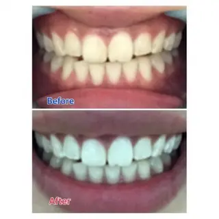 Ｍ渋谷 ホワイトニングのエステ・リラクイメージ