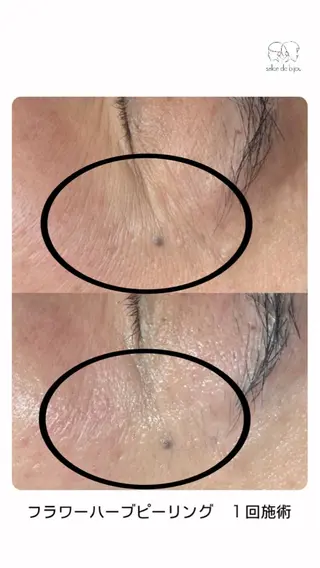 salon debijouのエステ・リラクイメージ