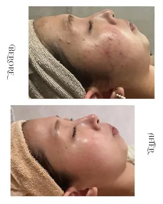 脱毛・肌質改善サロン Linoのエステ・リラクイメージ