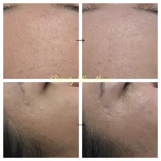 ビューティー ミロワールのエステ・リラクイメージ