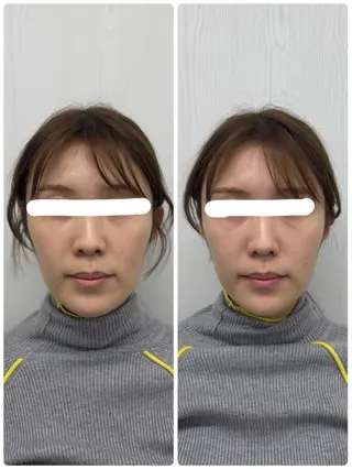 美容鍼×小顔矯正 ×美容整体　浜川泰仁のエステ・リラクイメージ