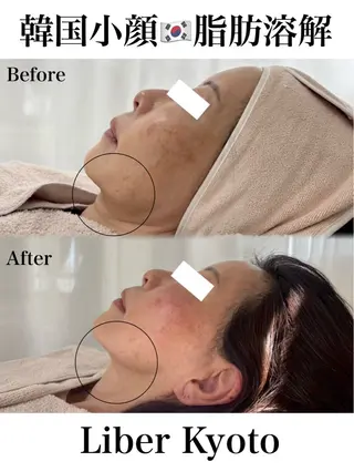 Liber【リベル】 AYAKAのエステ・リラクイメージ