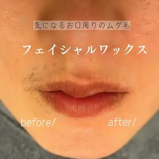 脱毛サロンLULA 恵比寿店　笠松のエステ・リラクイメージ