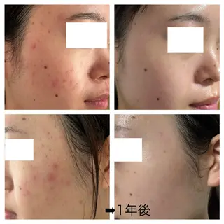 salon.plaisir（プレズィール）所属・酒井 瑠未のエステ・リラクイメージ