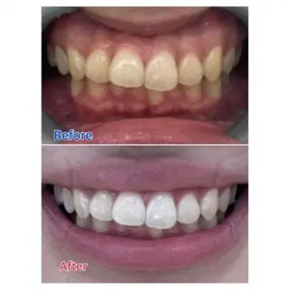 Ｍ渋谷 ホワイトニングのエステ・リラクイメージ