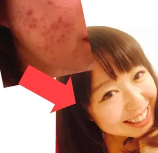 ニキビ跡専門サロン Ainaのエステ・リラクイメージ