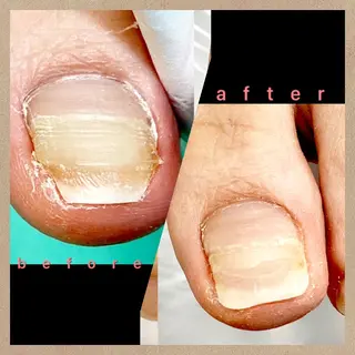 巻き爪補正店 大阪なんば店のネイルデザイン