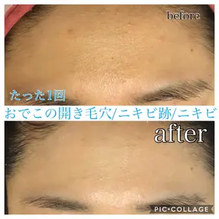ミディアム カラー パーマ ヘアアレンジ キッズ ネイル マツエク・マツパ EnsorClair 代表 野口真央のエステ・リラクイメージ