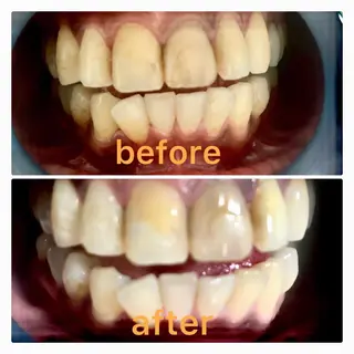 two nailのネイルデザイン