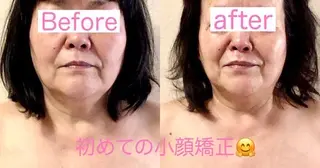 小顔矯正&ヘッドスパ haruhandのエステ・リラクイメージ
