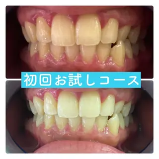 ホワイトニングルーム 横浜店のその他イメージ