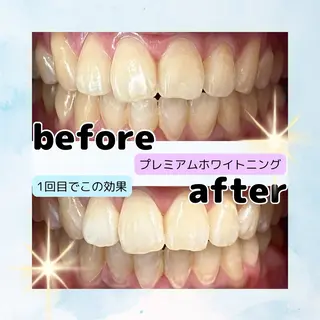 ホワイトニングサロン Soleilのその他イメージ