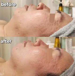 Shiny ✧︎*。のエステ・リラクイメージ