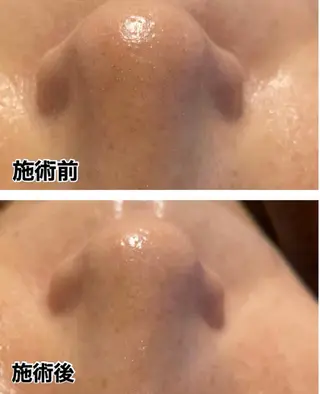 🌴Beauty Salon LANAのエステ・リラクイメージ