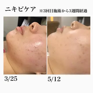 堀之内宏次 ［美容鍼灸師］のエステ・リラクイメージ