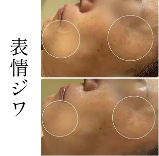 ハーブピーリング専門 BIOPLUS+川崎のエステ・リラクイメージ