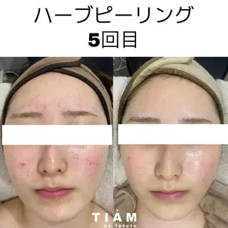 美肌サロンTIAM by tetoteのエステ・リラクイメージ