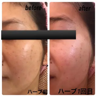 fairyrose organicエステのエステ・リラクイメージ