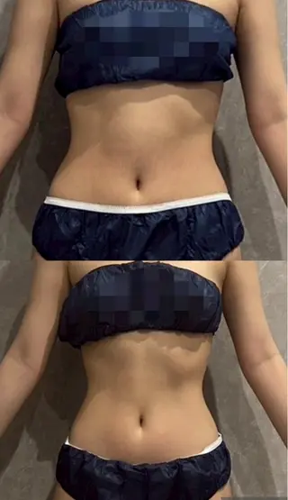 uni. beautyのエステ・リラクイメージ