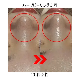 R-four🦋 土屋のエステ・リラクイメージ