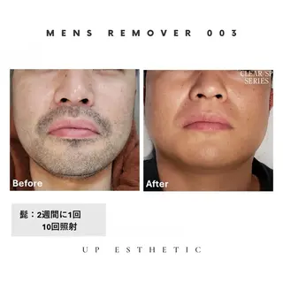 メンズ 韓国肌管理 ウプエステティックのエステ・リラクイメージ