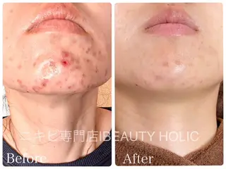 ビューティーホリック 東金店のエステ・リラクイメージ