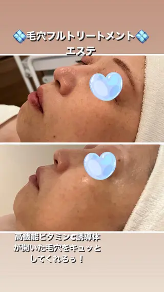 ナリスビューティーサロン池袋店所属・💎うる艶肌💎 スズキのエステ・リラクイメージ