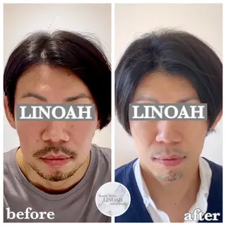 メンズ ビューティーサロン リノア心斎橋店のエステ・リラクイメージ