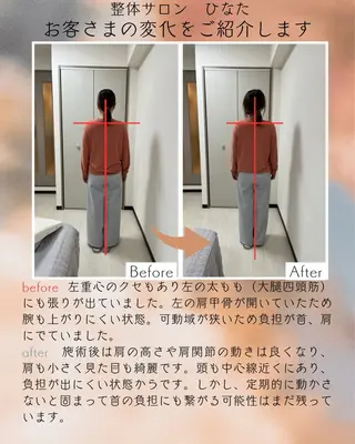 整体サロン　ひなた~HINATA~ 　京阪七条　京都店所属・整体×美姿勢メソッド 松山直樹のエステ・リラクイメージ
