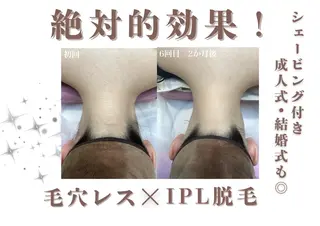 ヘアアレンジ U24限定クーポン レイビス池袋MANAのエステ・リラクイメージ