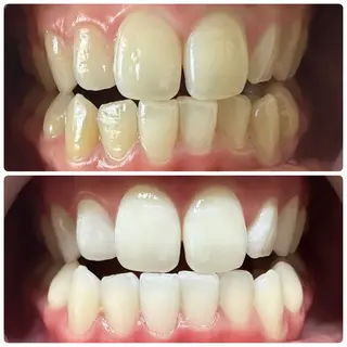 ネイル 歯のホワイトニング専門店＆white所属・歯のホワイトニング 専門店&whiteのその他イメージ