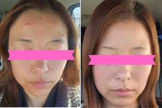 メディカルビューティーSalon Links所属・稲木 俊子のエステ・リラクイメージ