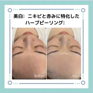 NA skin たまプラーザ　川島のエステ・リラクイメージ