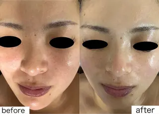 医療提携Beauty SalonMuseのエステ・リラクイメージ