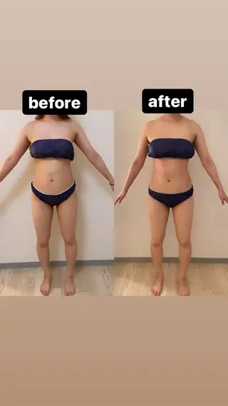 美容鍼WINBACK サロンRemeのエステ・リラクイメージ