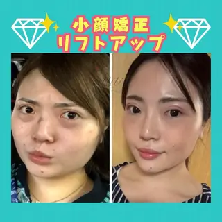 小顔サロンallilin所属・💎allilin 五所川原💎本間のエステ・リラクイメージ
