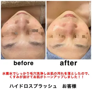 ネイル・エステサロン UILANIのネイルデザイン