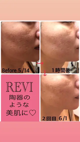 宜野湾美肌脱毛fuu okinawaタイラのエステ・リラクイメージ