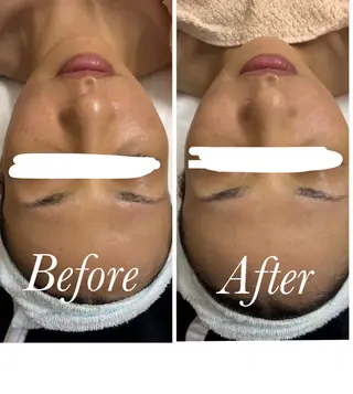 ビューティーサロン　プリズム所属・久留本 茜のエステ・リラクイメージ